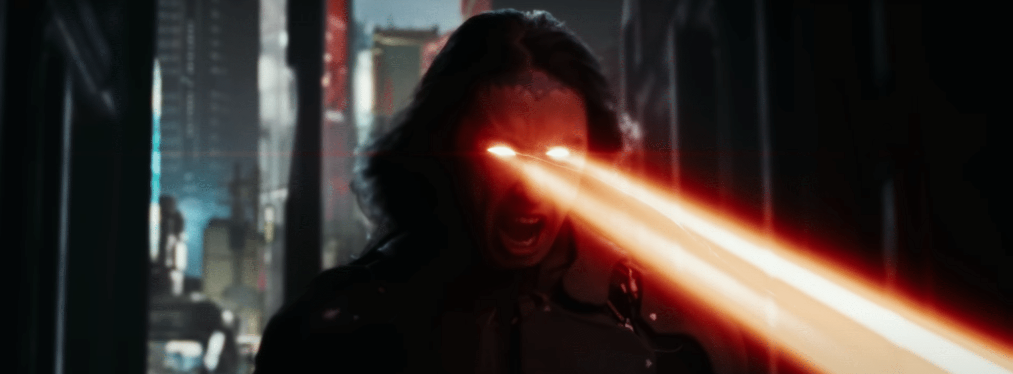 Ronnie Radke shoots lasers from his eyes.